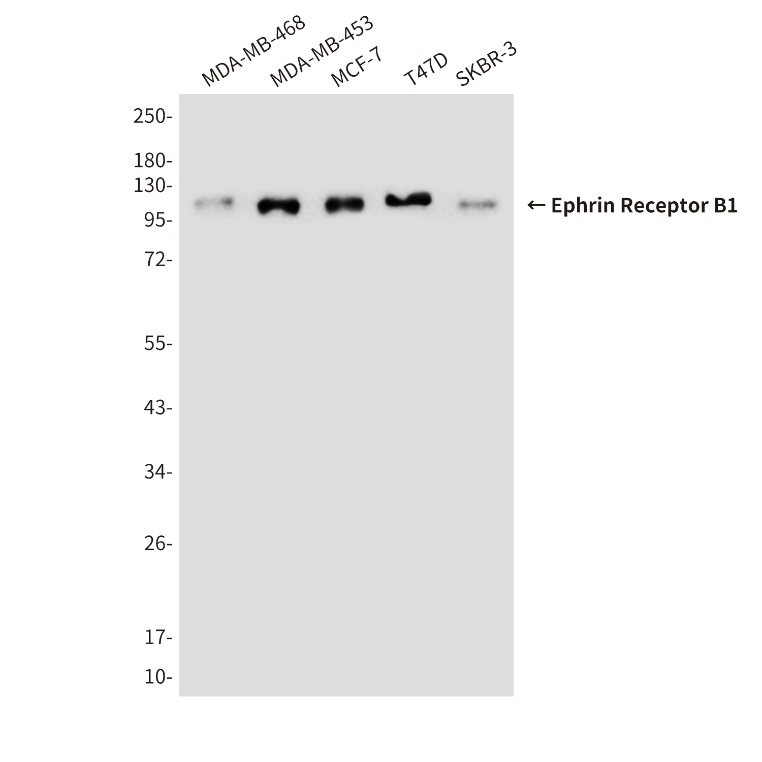 Ephrin Receptor B1 (9B4) Mouse mAb ABZ4092