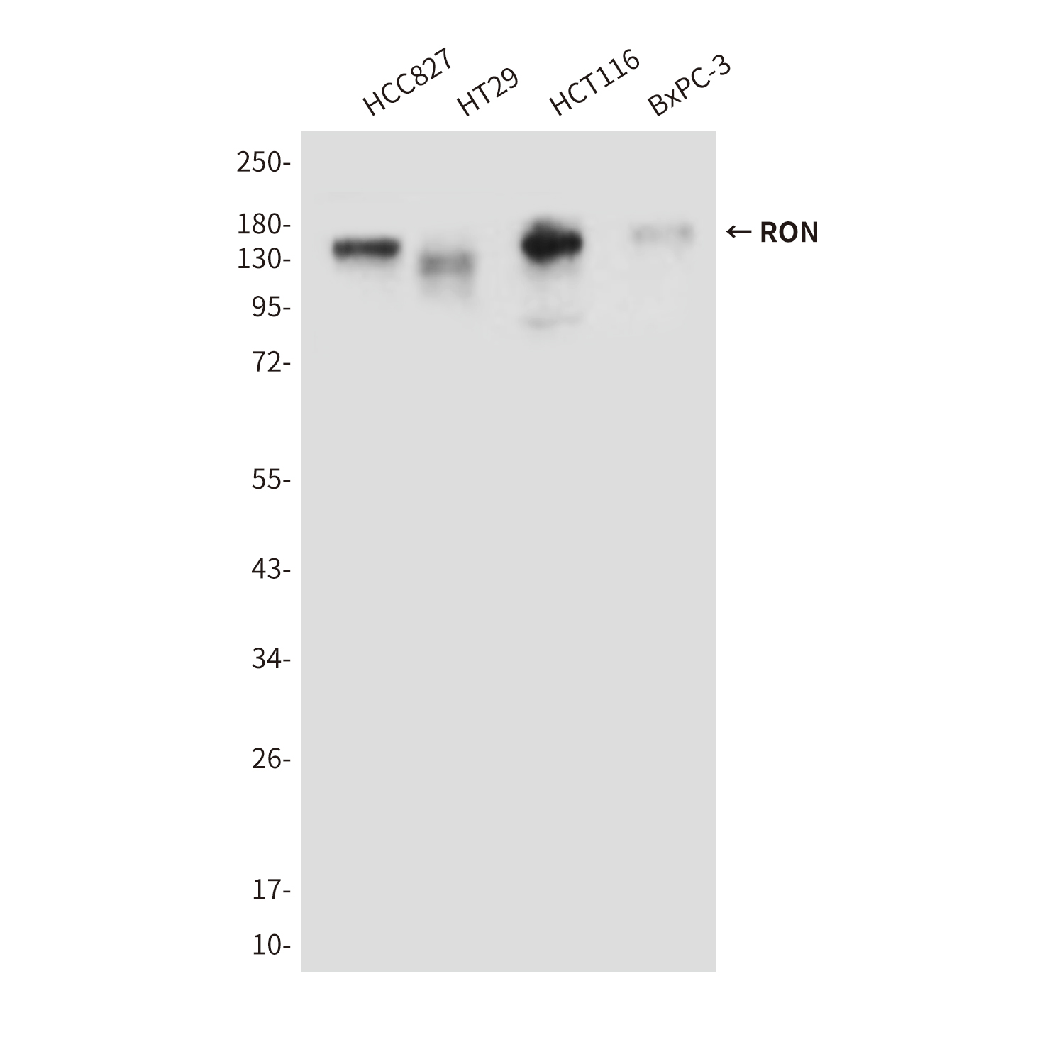 RON (9B6) Mouse mAb ABZ4093