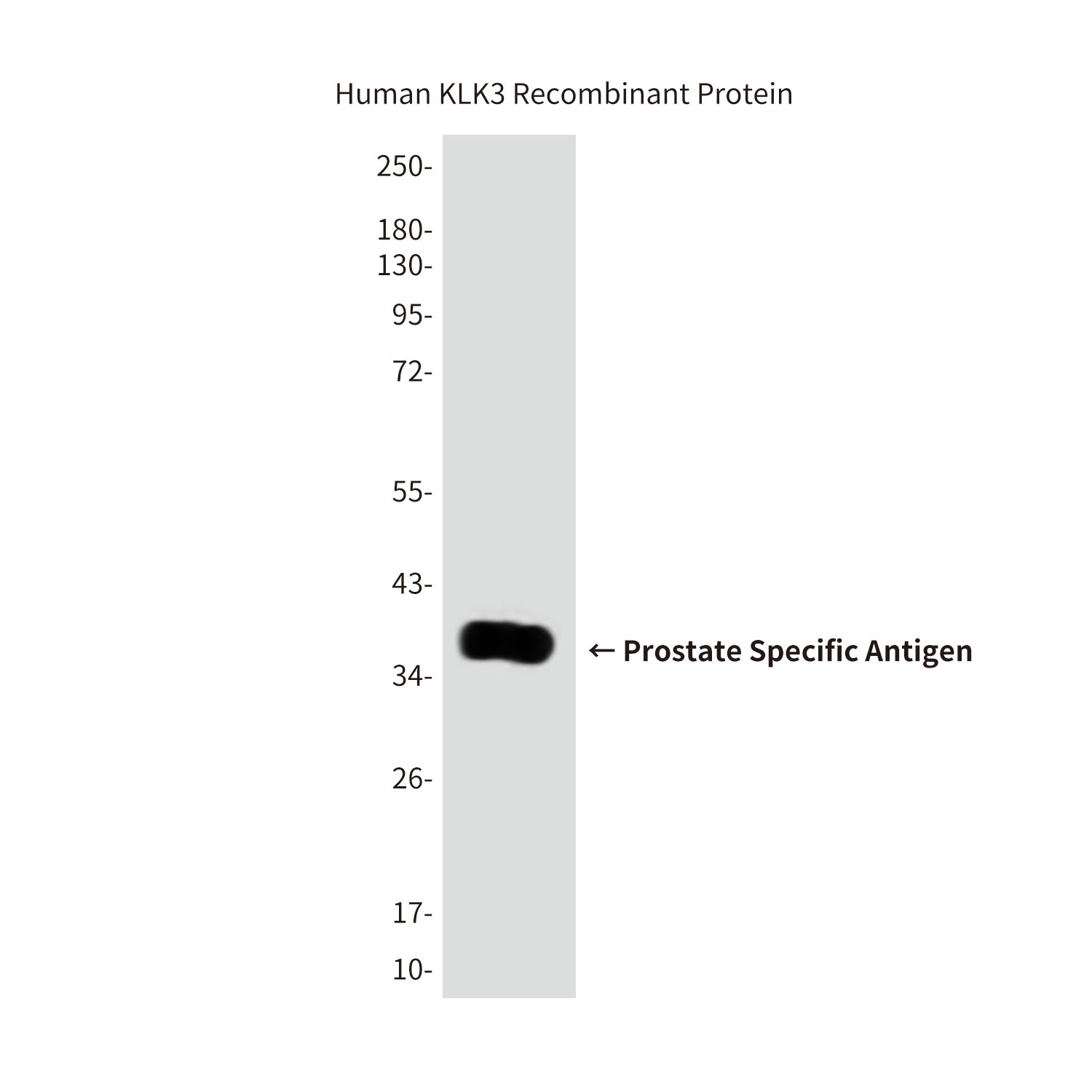 Prostate Specific Antigen Mouse mAb ABZ4095