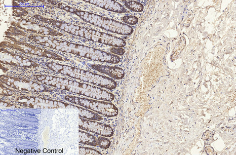 Cytokeratin 8 (10A5) Mouse mAb ABZ4096