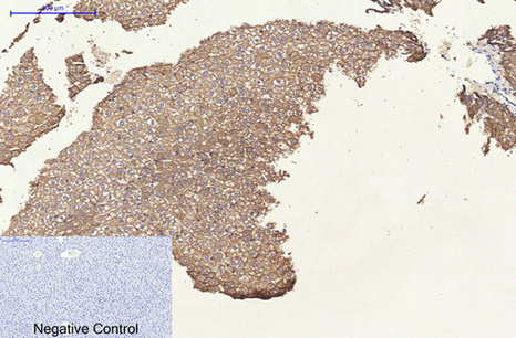 Cytokeratin 8 (10A5) Mouse mAb ABZ4096