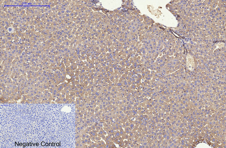 Cytokeratin 8 (10A5) Mouse mAb ABZ4096