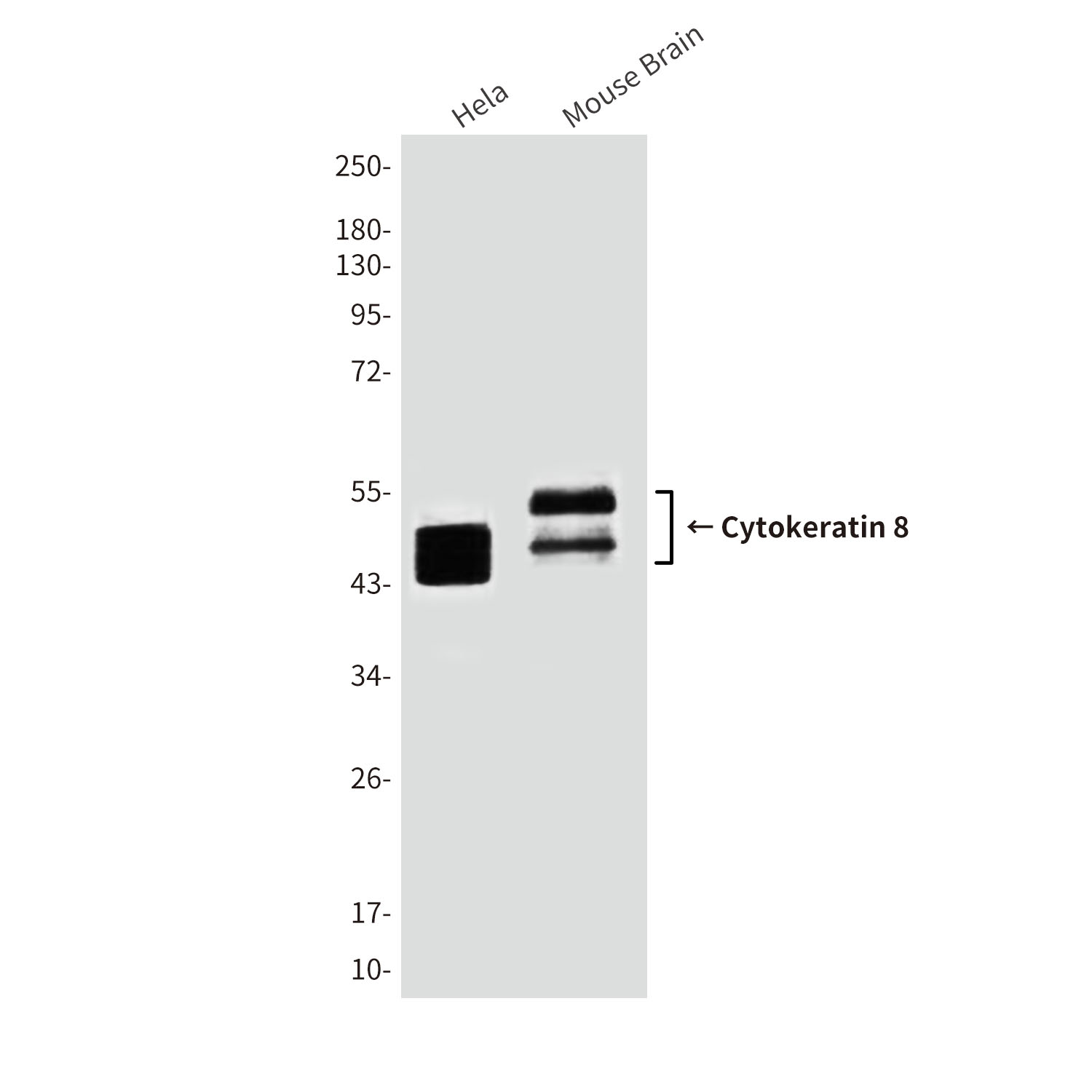 Cytokeratin 8 (10A5) Mouse mAb ABZ4096