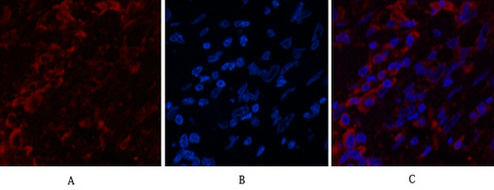 Cytokeratin 6 (1A5) Mouse mAb ABZ4097