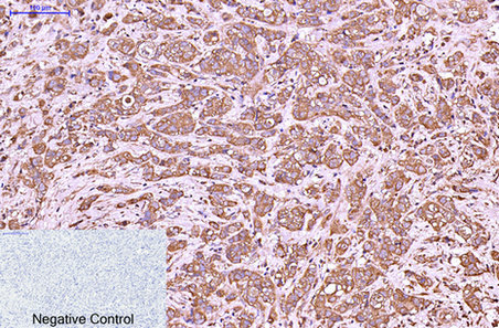 Cytokeratin 6 (1A5) Mouse mAb ABZ4097