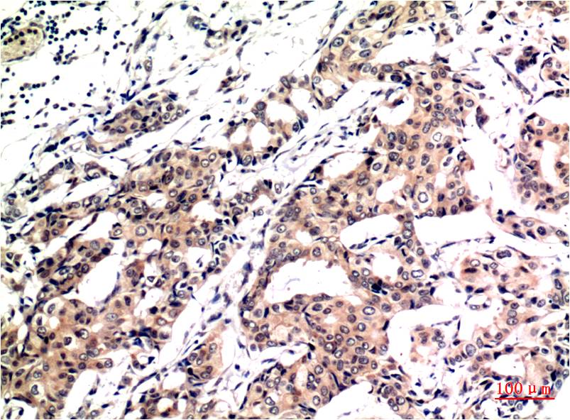 Ubiquitin (1B8) Mouse mAb ABZ4106