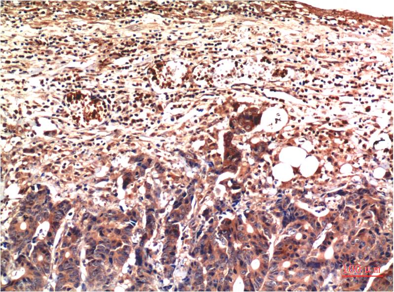 Ubiquitin (1B8) Mouse mAb ABZ4106