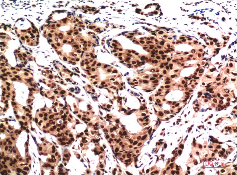 Ubiquitin (7F2) Mouse mAb ABZ4107
