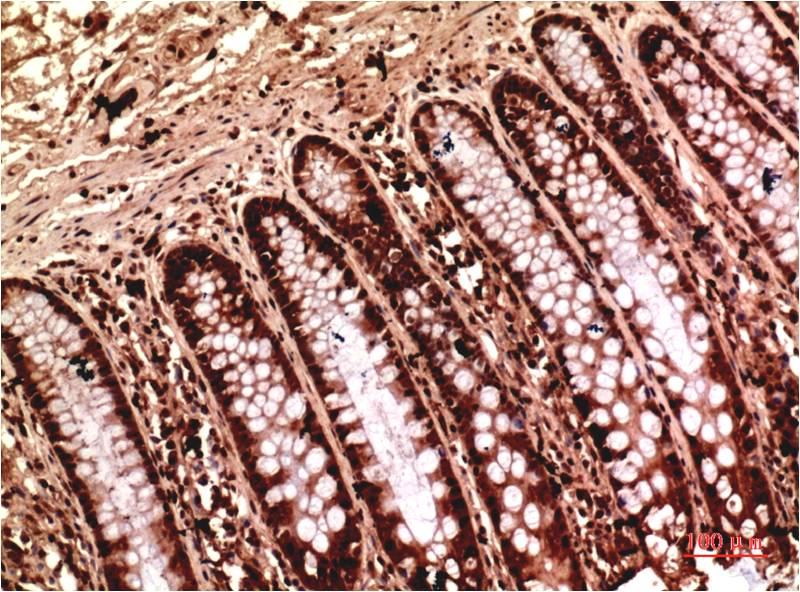 gamma Tubulin (6A10) Mouse mAb ABZ4108