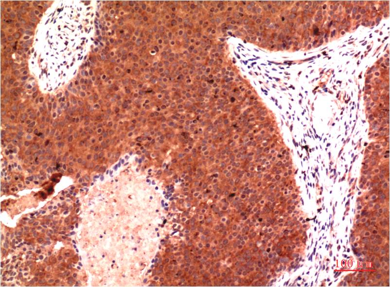 gamma Tubulin (6A10) Mouse mAb ABZ4108