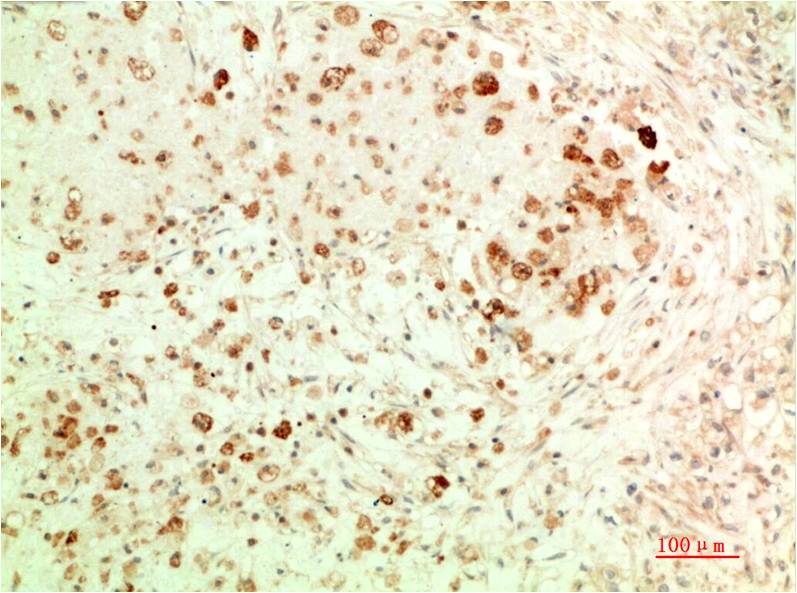 APG5L/ATG5 (3C10) Mouse mAb ABZ4110