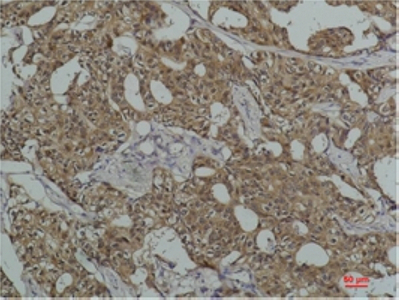 Hsc70 (5C2) Mouse mAb ABZ4112