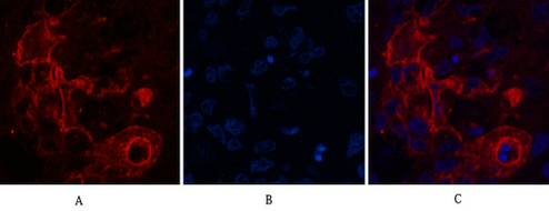 CEACAM5 (2A8) Mouse mAb ABZ4144