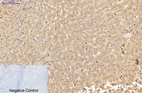 CEACAM5 (2A8) Mouse mAb ABZ4144