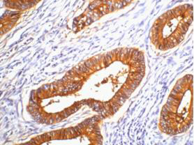 CEACAM5 (2A8) Mouse mAb ABZ4144
