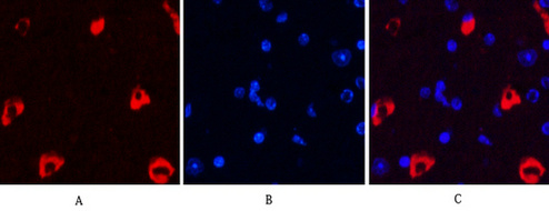 MAP2  Mouse mAb ABZ4145