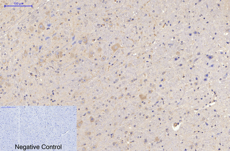 MAP2  Mouse mAb ABZ4145