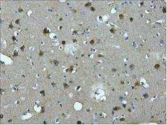MAP2  Mouse mAb ABZ4145