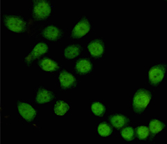 TBL1X (4H2) Mouse mAb ABZ4146