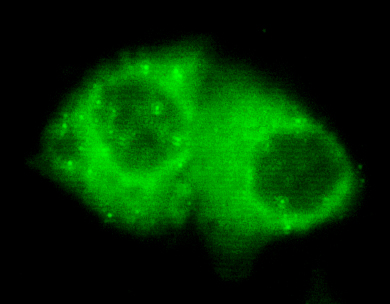 Cytokeratin 7 (4G9) Mouse mAb ABZ4151