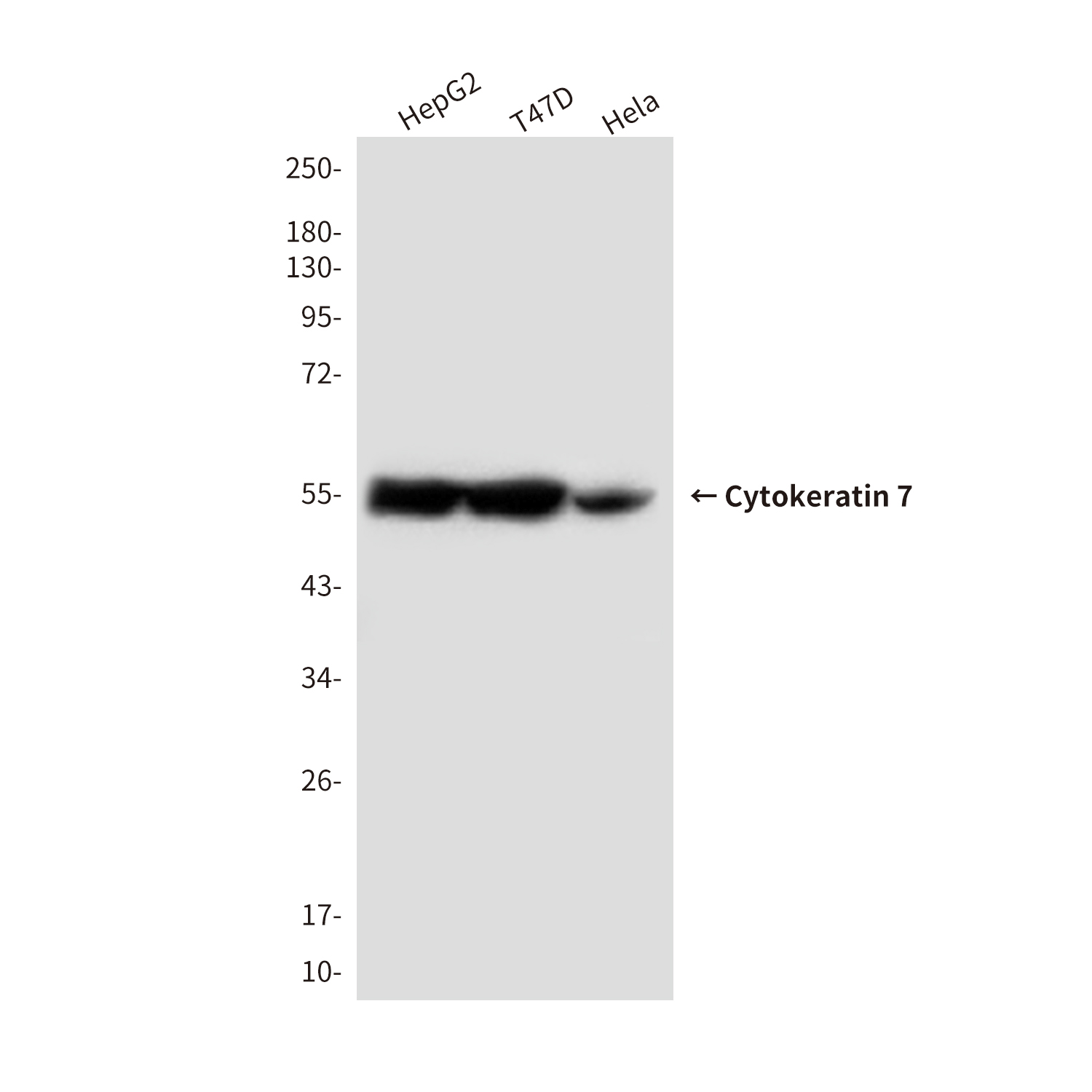 Cytokeratin 7 (4G9) Mouse mAb ABZ4151