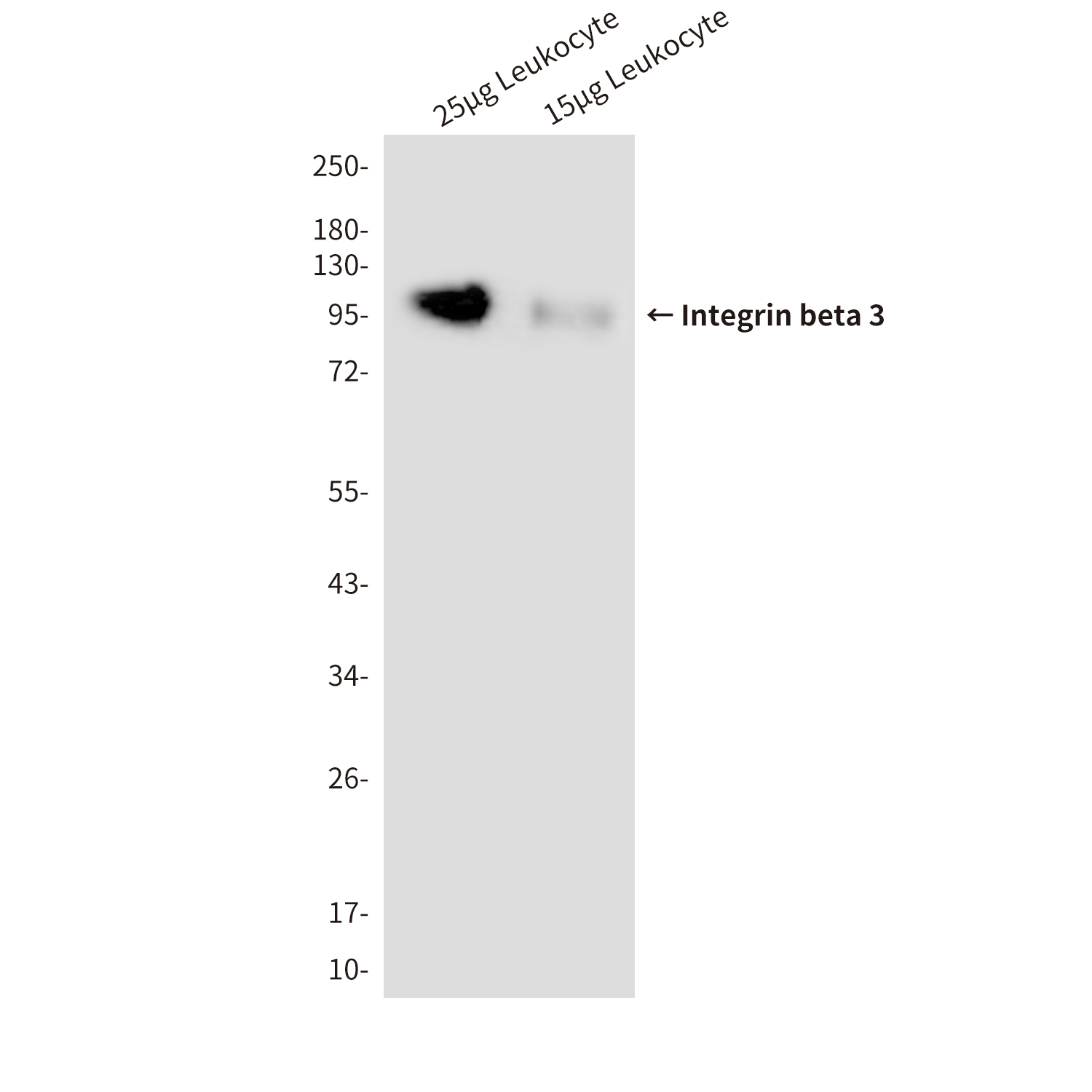 Integrin beta 3 Mouse mAb ABZ4154