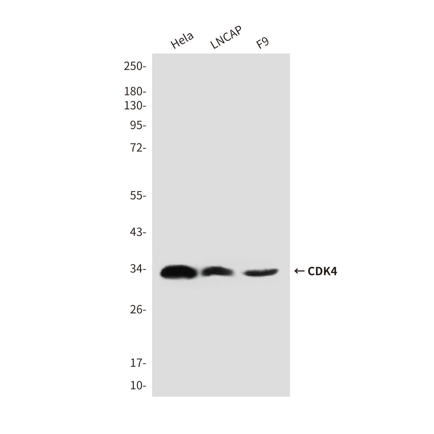 CDK4 Mouse mAb ABZ4156