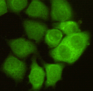 CDK1 (3B9) Mouse mAb ABZ4158