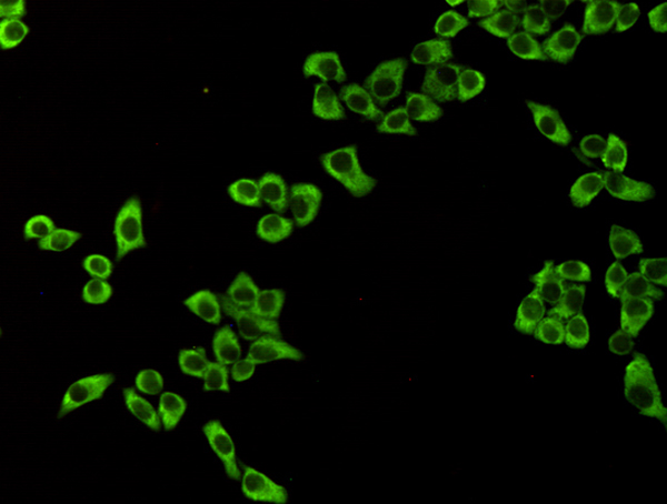 EEF2/Elongation factor 2 (4B3) Mouse mAb ABZ4159