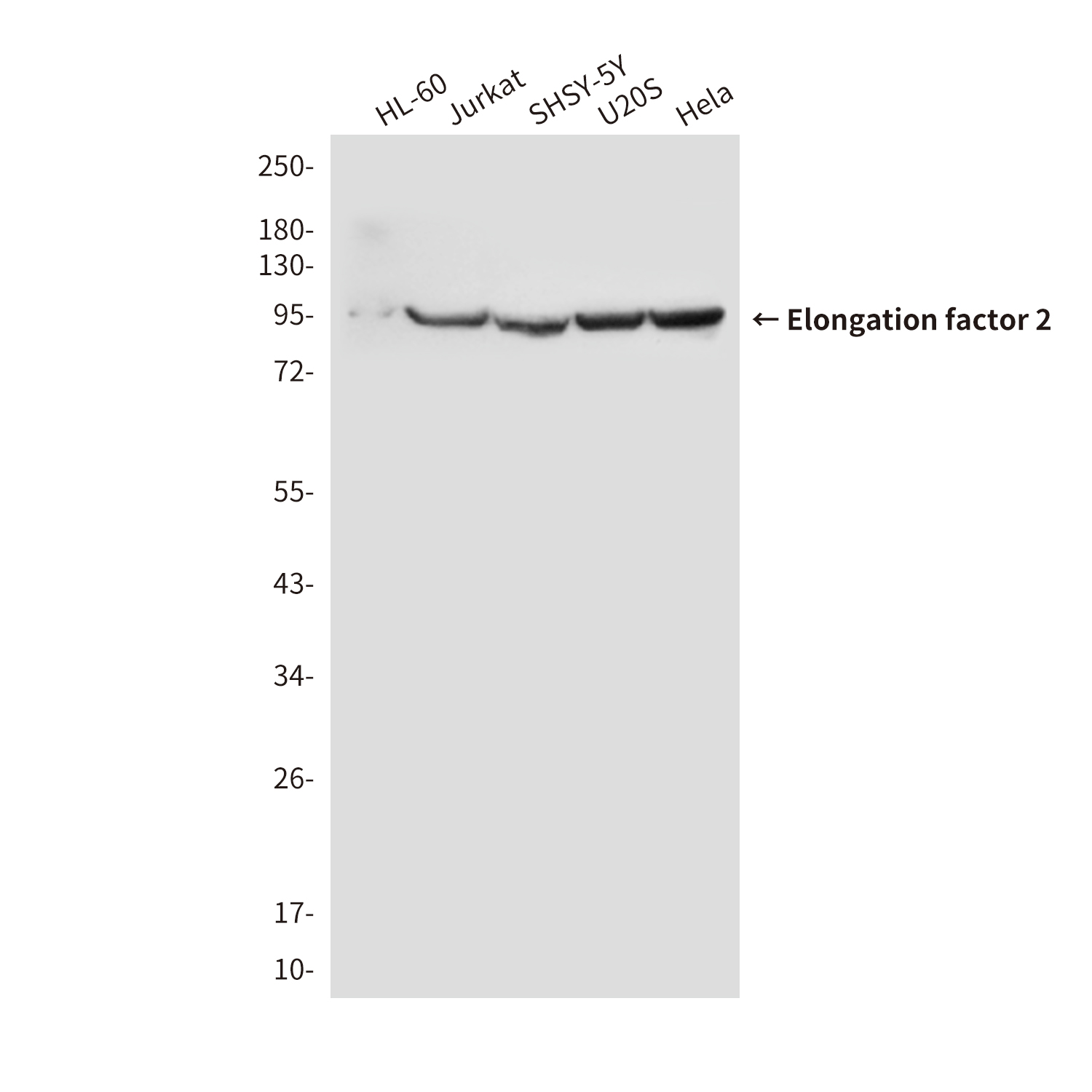 EEF2/Elongation factor 2 (4B3) Mouse mAb ABZ4159