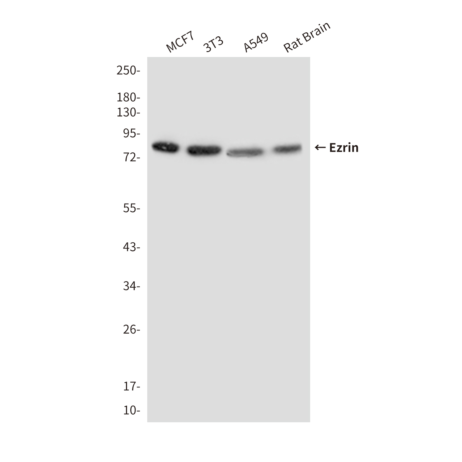 Ezrin (2C12) Mouse mAb ABZ4163