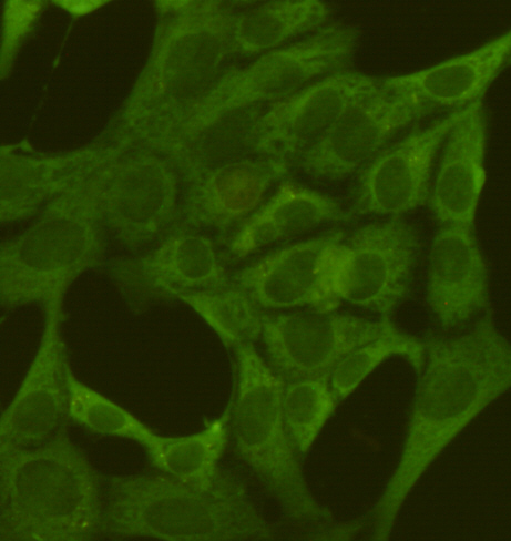 PKM2 (1F2) Mouse mAb ABZ4167