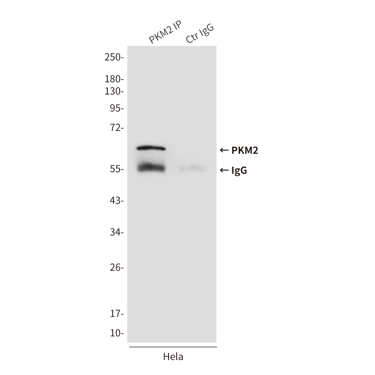 PKM2 (1F2) Mouse mAb ABZ4167