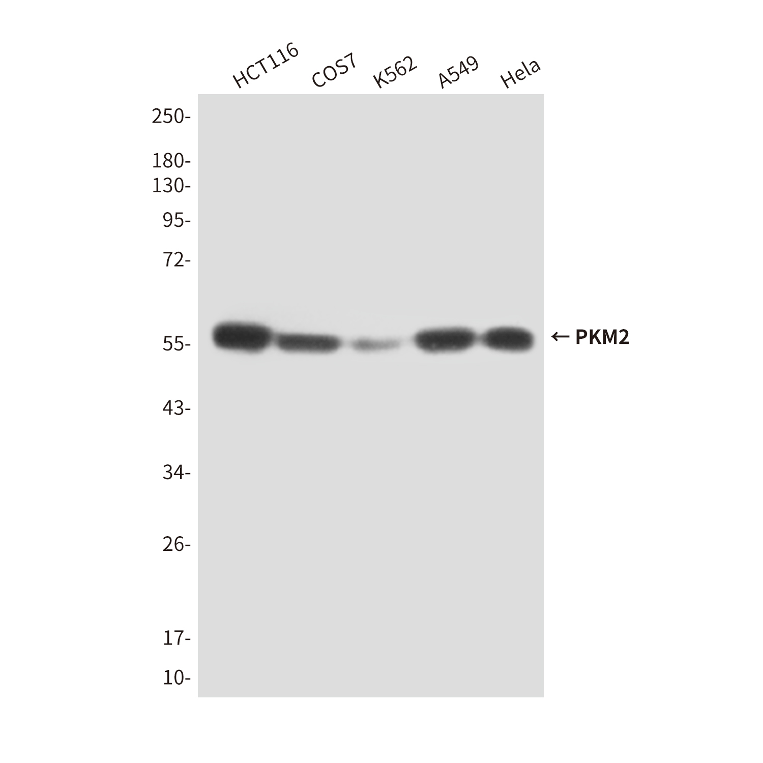 PKM2 (1F2) Mouse mAb ABZ4167
