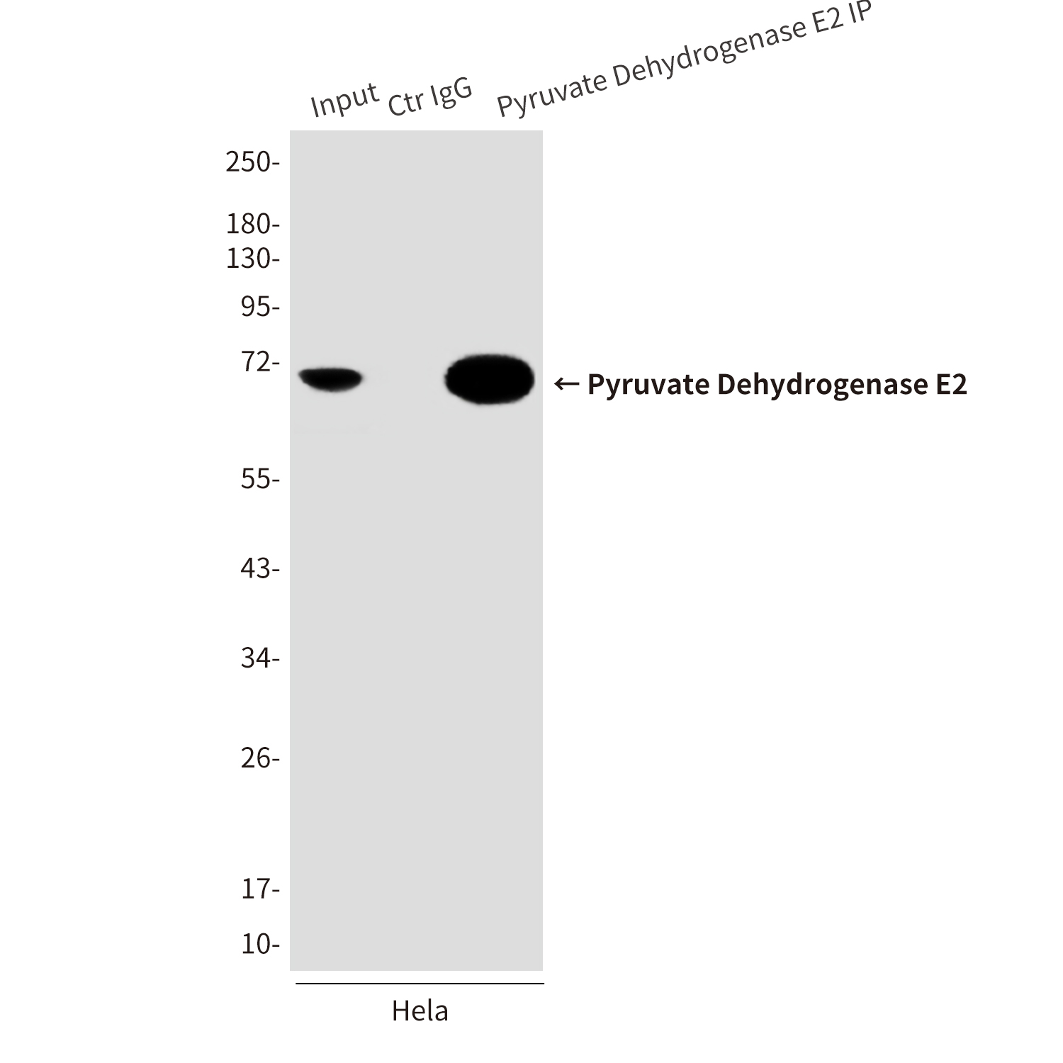 Pyruvate Dehydrogenase E2 (4A4) Mouse mAb ABZ4169
