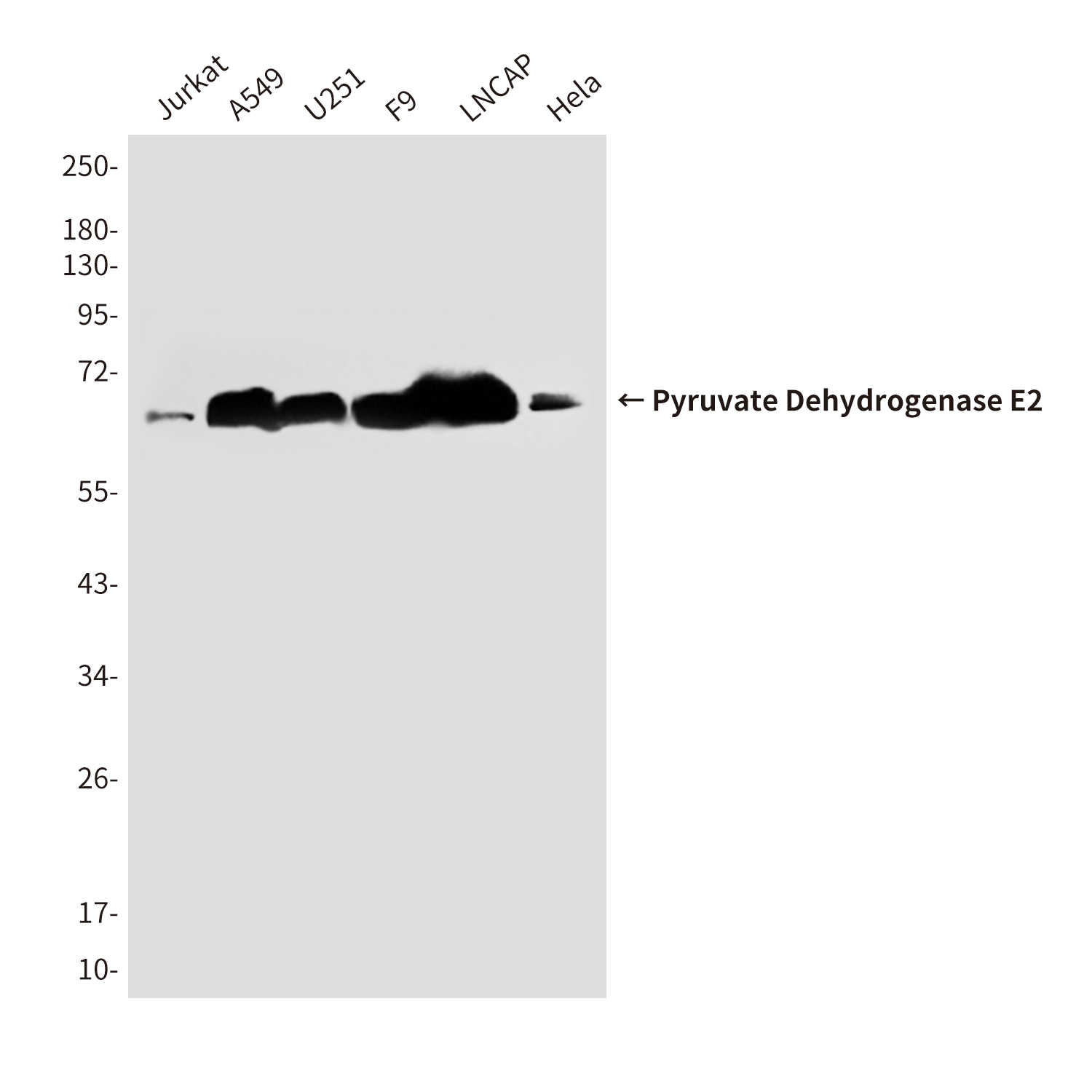 Pyruvate Dehydrogenase E2 (4A4) Mouse mAb ABZ4169