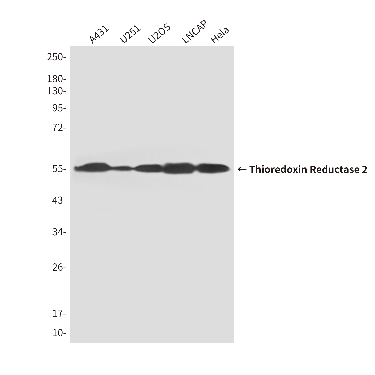 TXNRD2 (3F2) Mouse mAb ABZ4170