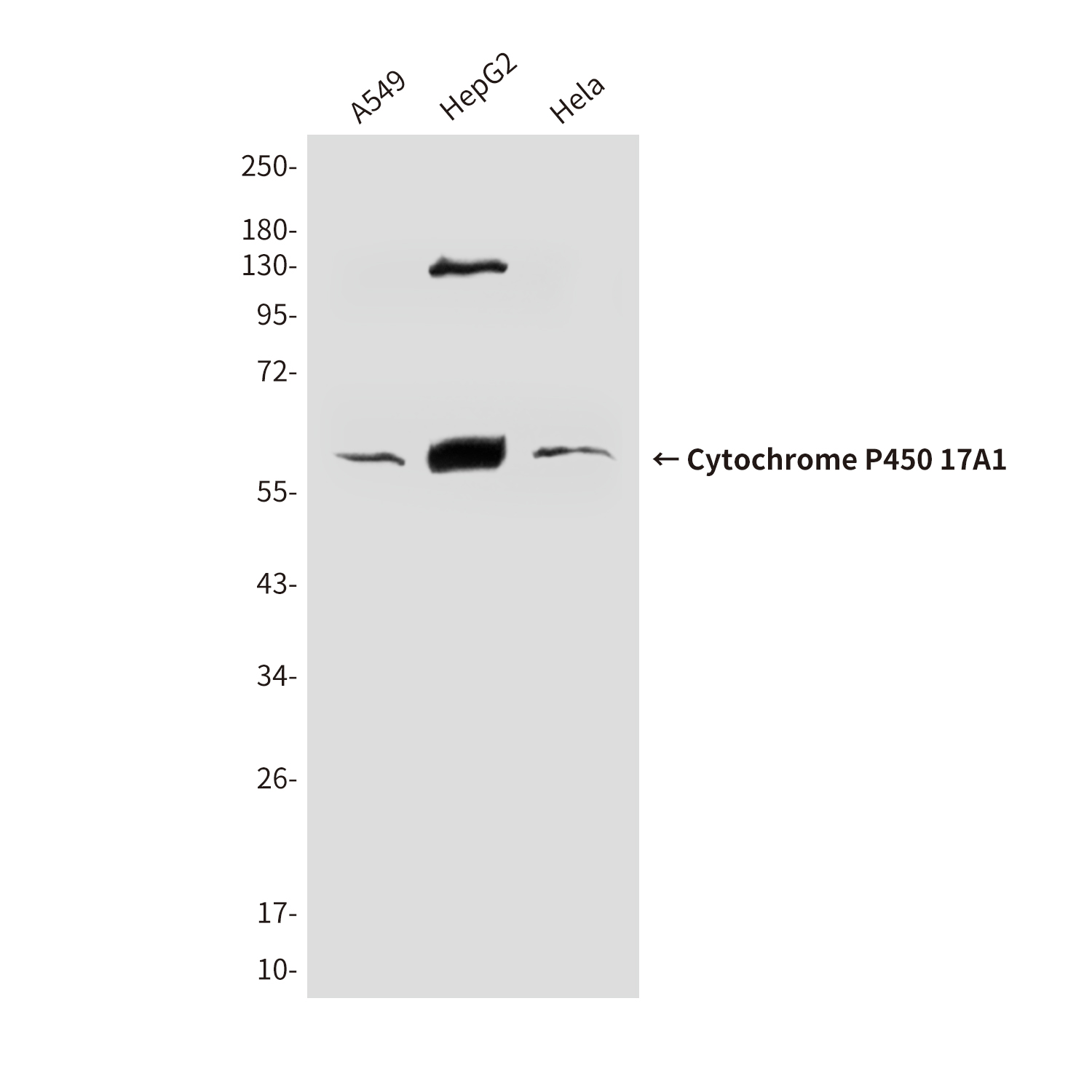 Cytochrome P450 17A1/CYP17A1 Mouse mAb ABZ4173