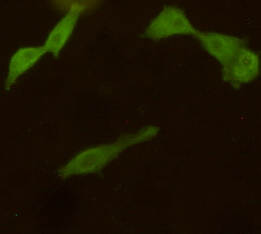 UCH-L1/PGP9.5 (7B8) Mouse mAb ABZ4175