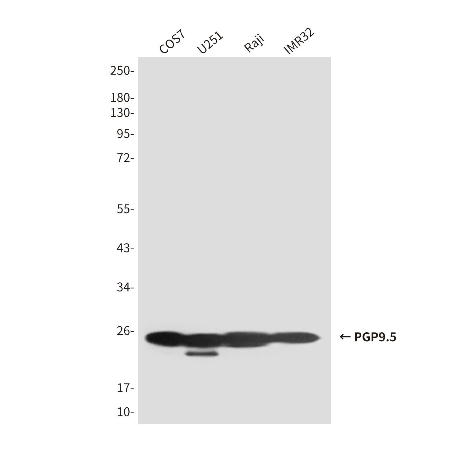 UCH-L1/PGP9.5 (7B8) Mouse mAb ABZ4175