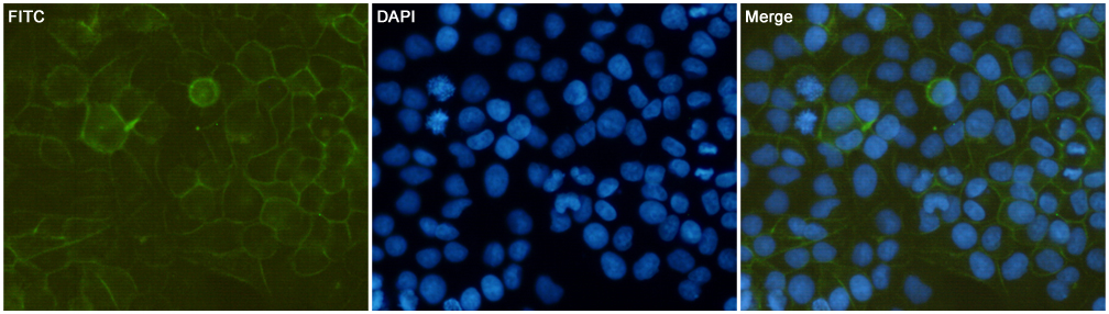 CD44 Mouse mAb ABZ4178