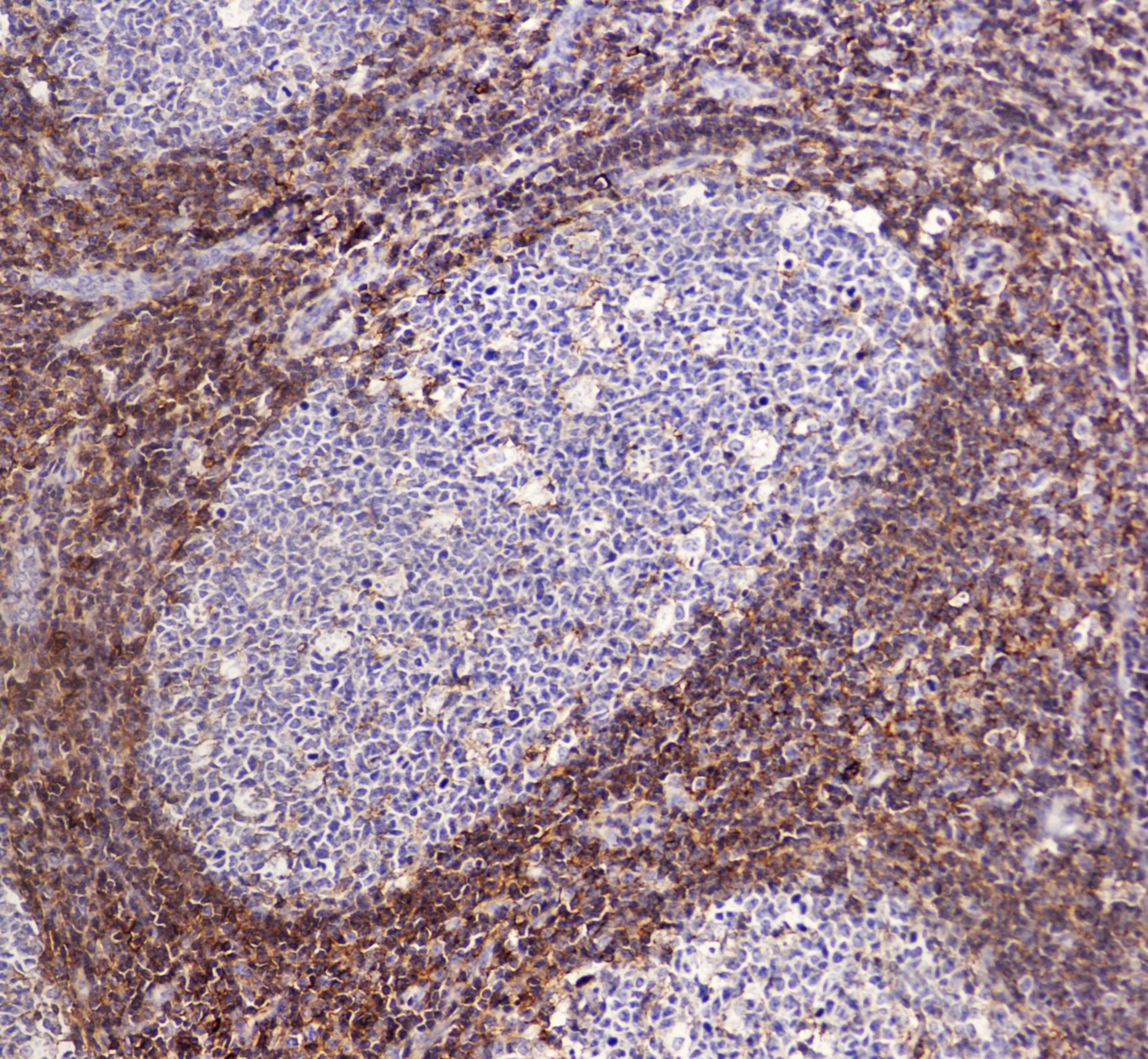 CD44 Mouse mAb ABZ4178