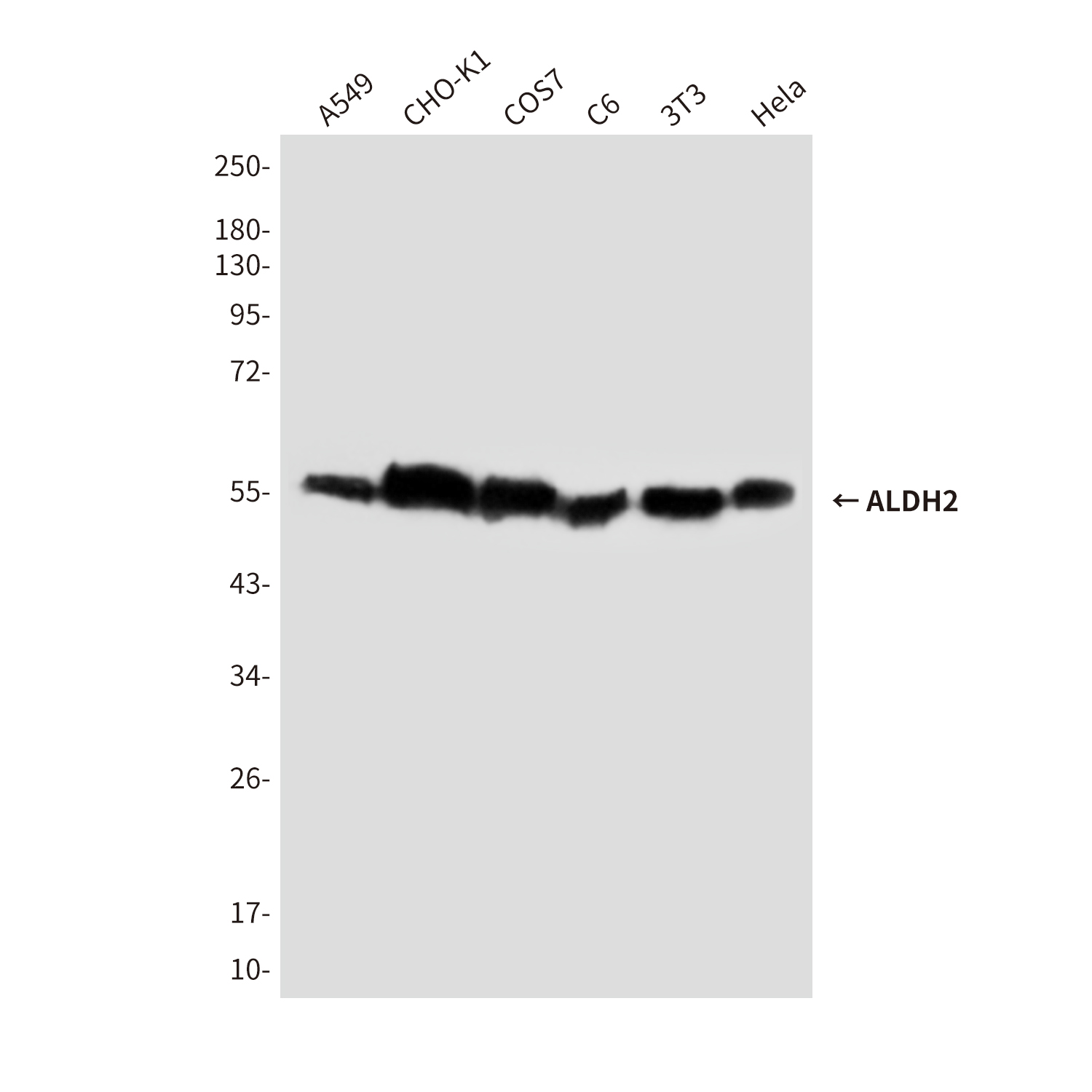 ALDH2 Mouse mAb ABZ4179