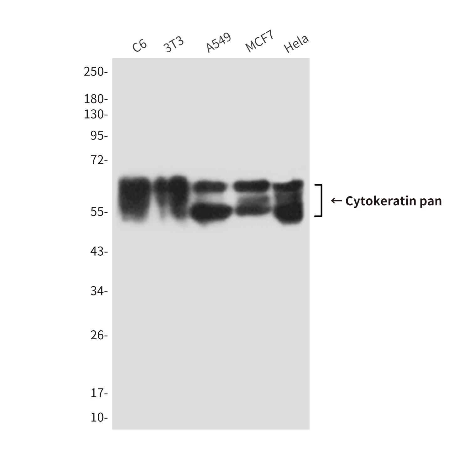 Cytokeratin 5 Mouse mAb ABZ4189