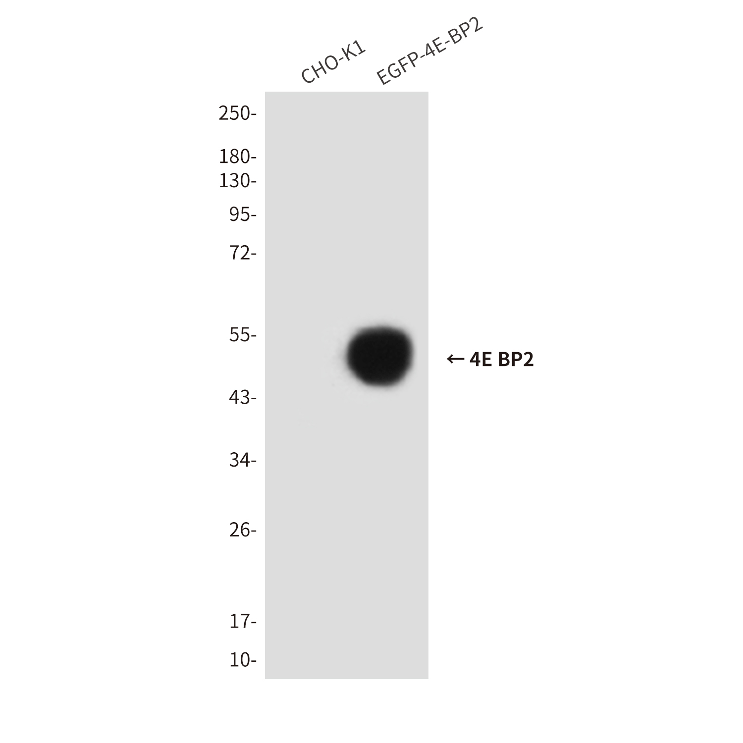 4E BP2 (7A6) Mouse mAb ABZ4203