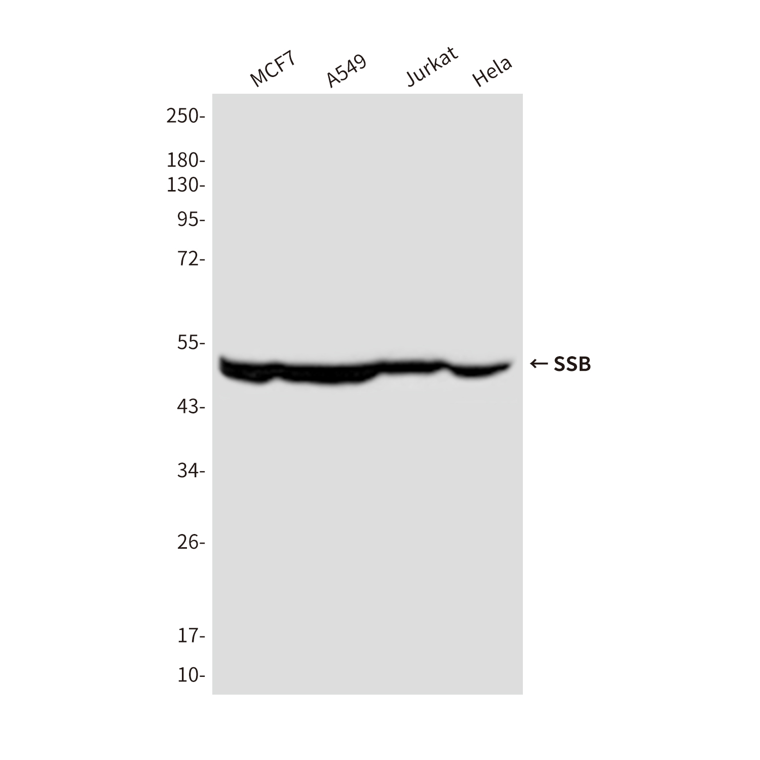 SSB (4B10) Mouse mAb ABZ4208