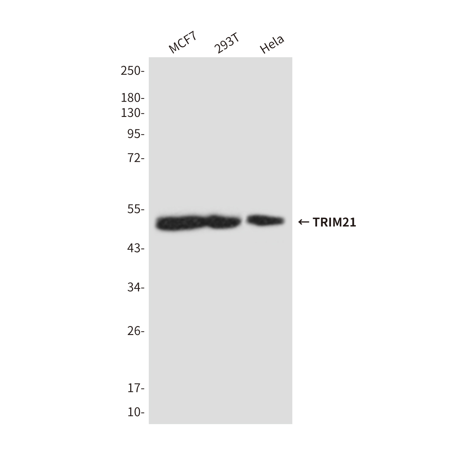 TRIM21 (5B9) Mouse mAb ABZ4209