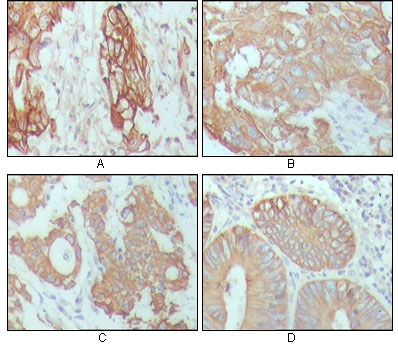 Cytokeratin 18 (6A8) Mouse mAb ABZ4214