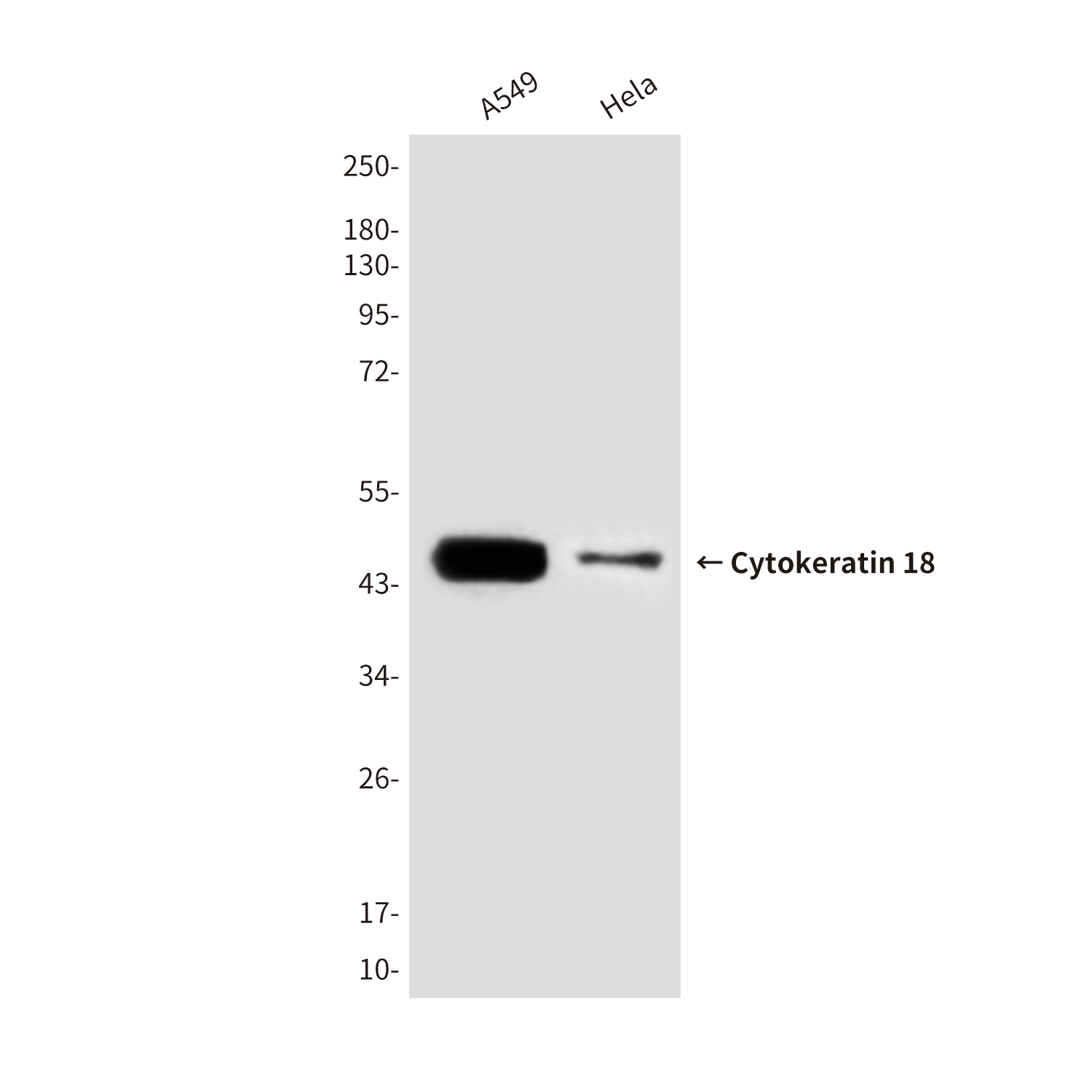 Cytokeratin 18 (6A8) Mouse mAb ABZ4214