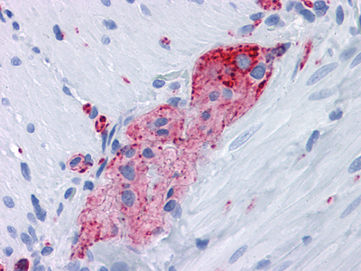 Synaptophysin (10C8) Mouse mAb ABZ4215